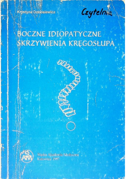 Boczne idiopatyczne skrzywienia kręgosłupa