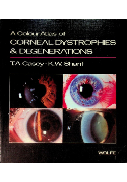A Colour Atlas of Corneal Dystrophies and Degenerations