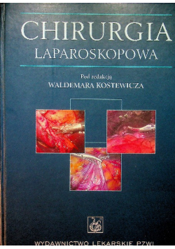Chirurgia laparoskopowa