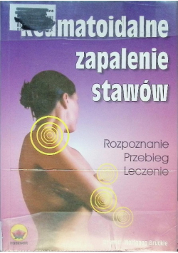 Reumatoidalne zapalenie stawów