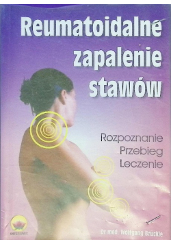 Reumatoidalne zapalenie stawów