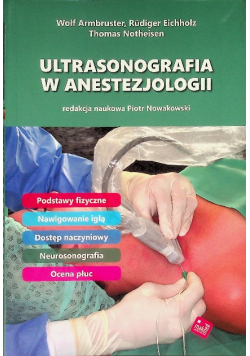 Ultrasonografia w anestezjologii