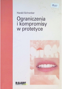 Ograniczenia i kompromisy w protetyce