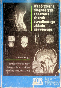 Współczesna diagnostyka obrazowa chorób ośrodkowego układu nerwowego