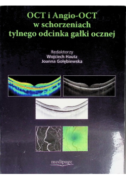 Oct I Angio-Oct W Schorzeniach Tylnego Odcinka Gałki Ocznej
