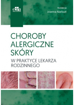 Choroby alergiczne skóry w praktyce lekarza rodzinnego