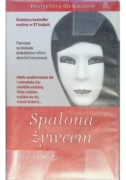 Spalona żywcem