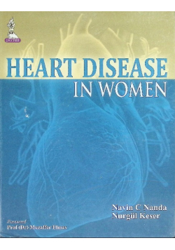Heart disease in women