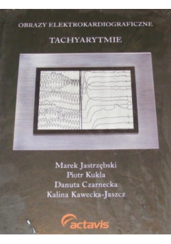 Obrazy elektrokardiograficzne tachyarytmie