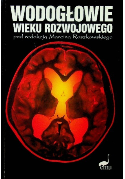 Wodogłowie wieku rozwojowego
