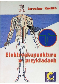 Elektroakupunktura w przykładach