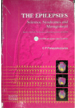 The Epilepsies: Seizures, Syndromes and Management