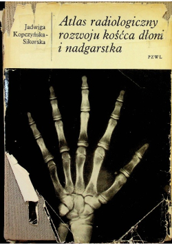Atlas radiologiczny rozwoju kośćca dłoni i nadgarstka