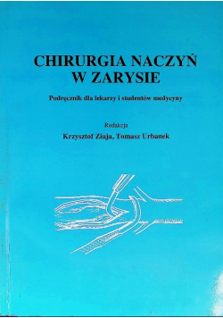 Chirurgia naczyń w zarysie