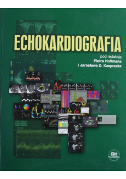 Echokardiografia