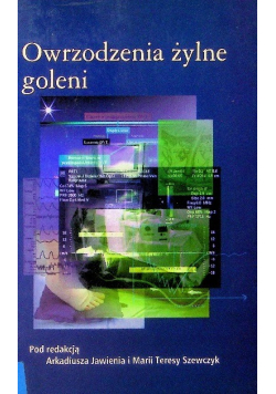 Owrzodzenia żylne goleni