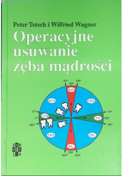 Operacyjne usuwanie zęba mądrości