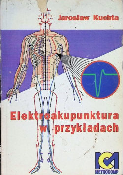 Elektroakupunktura w przykładach