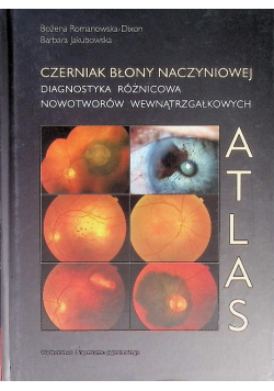 Czerniak błony naczyniowej Diagnostyka różnicowa nowotworów wewnątrzgałkowych