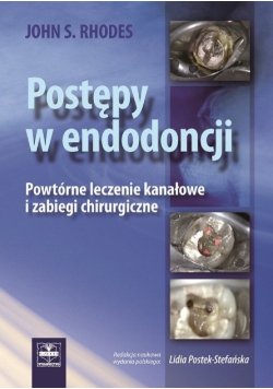 Postępy w endodoncji Powtórne leczenie kanałowe i zabiegi chirurgiczne