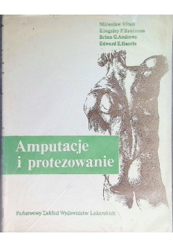 Amputacje i protezowanie