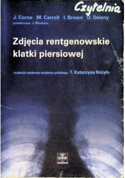Zdjecie rentgenowskie klatki piersiowej