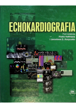 Echokardiografia
