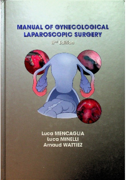 Manual of gynecologcal laparoscopic sugery