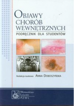 Objawy chorób wewnętrznych