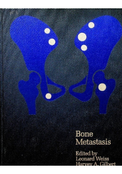 Bone Metastasis