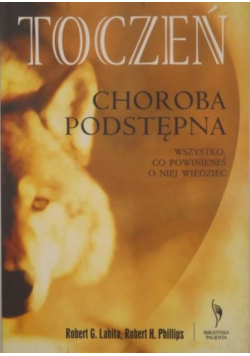 Toczeń choroba podstępna