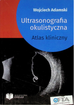 Ultrasonografia okulistyczna Atlas kliniczny