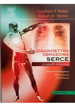 Diagnostyka obrazowa serca przypadki kliniczne
