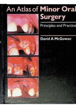 An Atlas of Minor Oral Surgery Principles of Practice