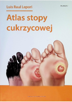 Atlas stopy cukrzycowej