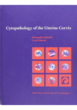Cytopathology of the Uterine Cervix Vol 1