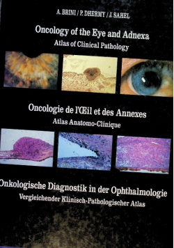 Oncology of the Eye and Adnexa