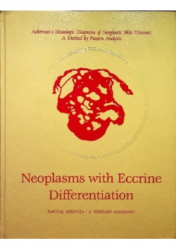 Neoplasms with Eccrine Differentiation