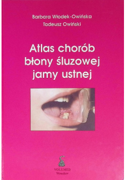 Atlas chorób błony śluzowej jamy ustnej