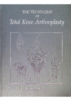 The Technique of Total Knee Arthroplasty