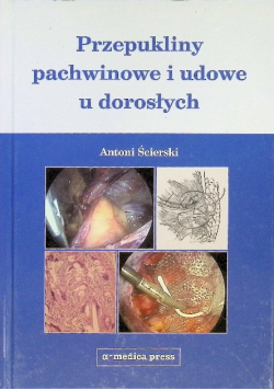 Przepukliny pachwinowe i udowe u dorosłych