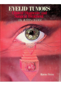 Eyelid tumors Clinical Diagnosis and Surgical Treatment