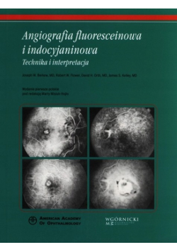 Angiografia fluoresceinowa i indocyjaninowa