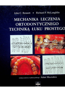 Mechanika leczenia ortodontycznego techniką łuku prostego