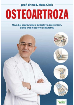 Osteoartroza