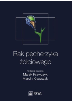 Rak pęcherzyka żółciowego