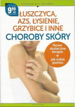 Łuszczyca azs łysienie grzybice i inne choroby skóry