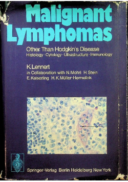 Malignant Lymphomas