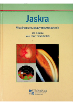 Jaskra Współczesne zasady rozpoznawania