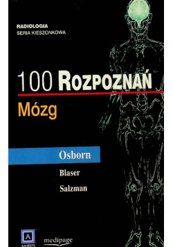 100 rozpoznań  mózg